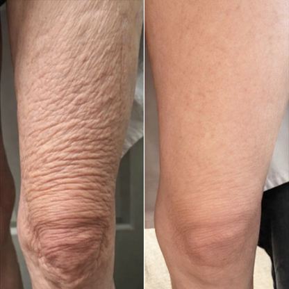KLENIMORE™ Collagen Firming Cream💖LAST DAY SALE - 60% OFF