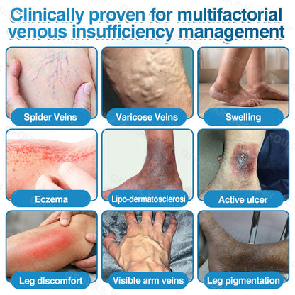 🇨🇦👨‍⚕️✅👍GFOUK® VeinRepair Microneedle Patch Roll⚡Instant Relief, Long-Term Results