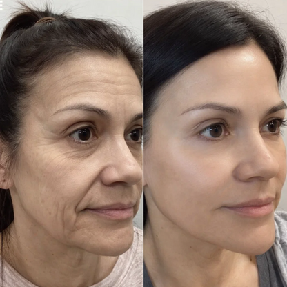 KLENIMORE™ Collagen Firming Cream💖LAST DAY SALE - 60% OFF